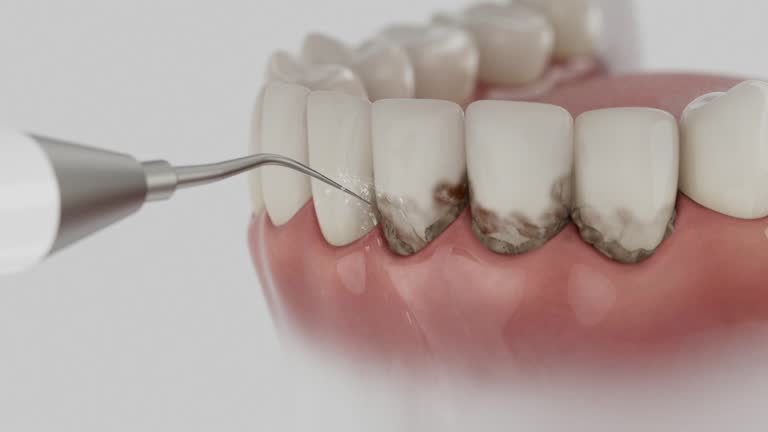 Trusted Dental Crowns And Bridges service in South Hutchinson, KS - Dentist Open Now